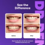 Dr Dent Purple Teeth Whitening Strips ( The Couple's Bundle ) - Image 3